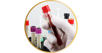 Link to: /programs/micronutrient-testing